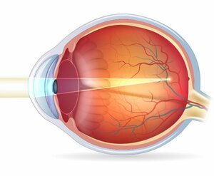 Что такое близорукость глаз