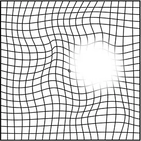 следите за давлением