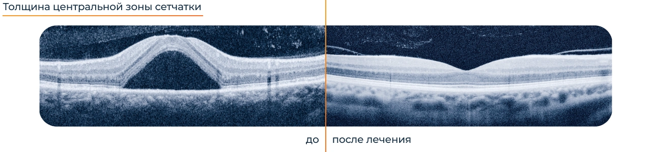 Результаты лечения