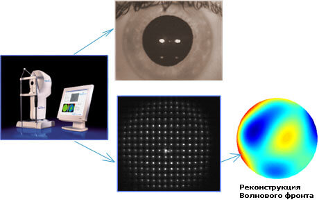 Как происходит аберрометрический анализ?