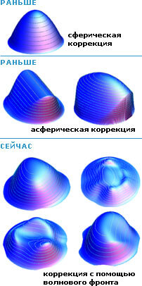 Методы определения аберрации глаза