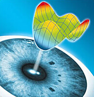 Волновой фронт, аборрометрический анализ